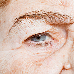 macular degeneration eyes