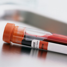 blood test for high cholesterol statin drugs
