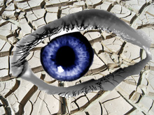 dry eyes