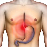 acid reflux 