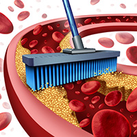 macular degeneration - statin