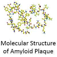 amyloid plaque