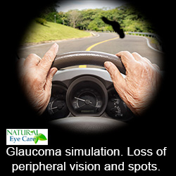 glaucoma simulation risk