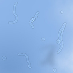 floaters