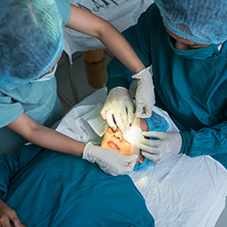 cataract surgery