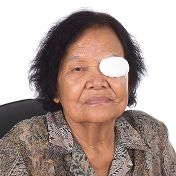cornea transplant