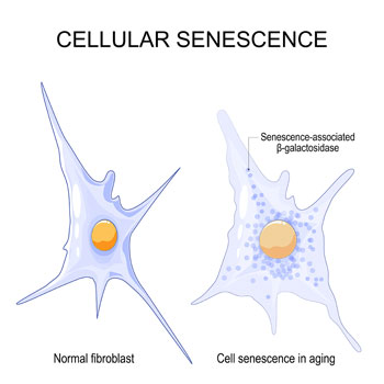 senescent cell vs normal cell