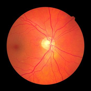 retina scan