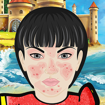 Ocular Rosacea