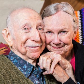 Senior man and woman with hair loss